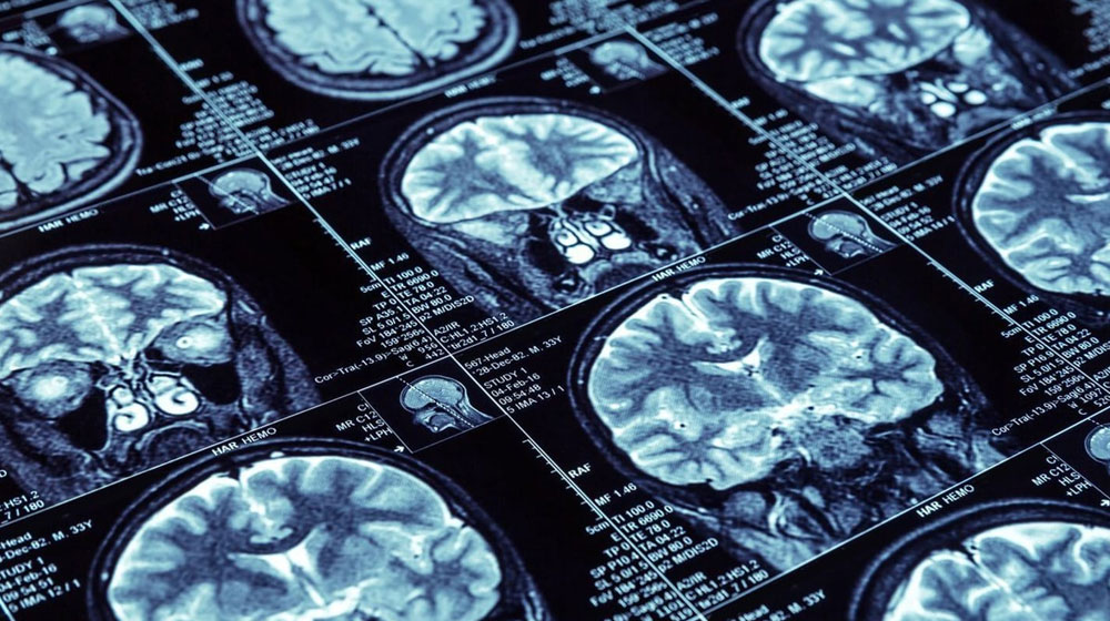 MRI scans of human brain cross-sections